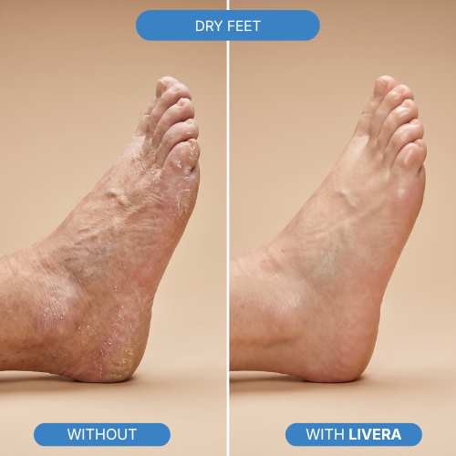 Get Rid of<strong> Dry Cracked Feet In Less Than 1 Week</strong>