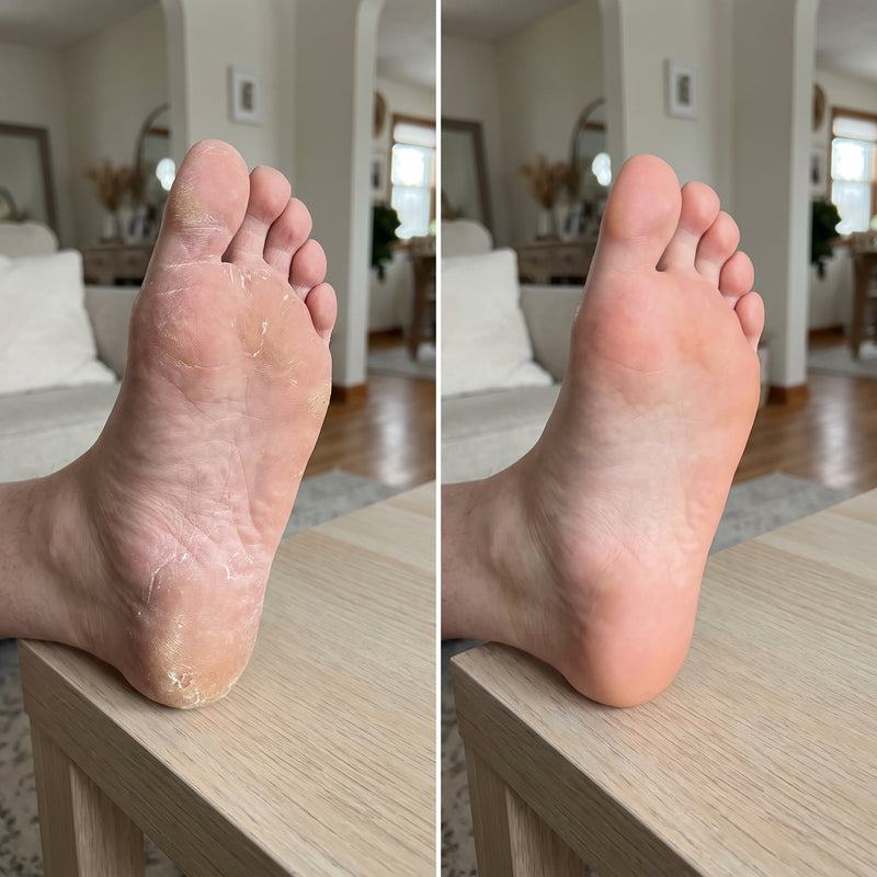 Soft Feet in One Week