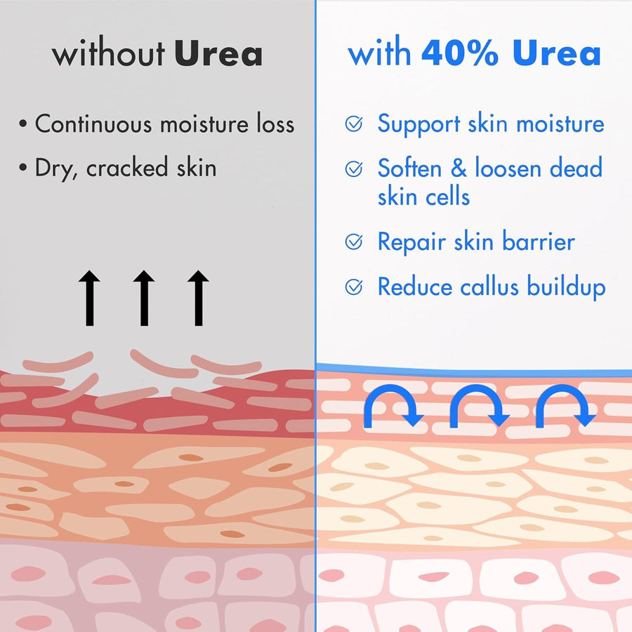 Get Rid of<strong> Dry Cracked Feet In Less Than 1 Week</strong>